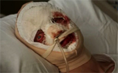 Clayface